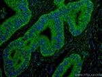 ING4 Antibody in Immunohistochemistry (Paraffin) (IHC (P))