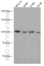 CCDC45 Antibody in Western Blot (WB)