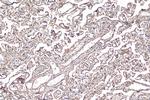 IL-6RB Antibody in Immunohistochemistry (Paraffin) (IHC (P))