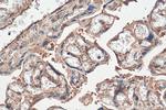 IL-6RB Antibody in Immunohistochemistry (Paraffin) (IHC (P))