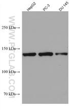 IL-6RB Antibody in Western Blot (WB)