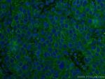 ALCAM Antibody in Immunohistochemistry (Paraffin) (IHC (P))