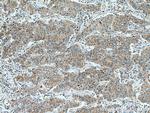 ALCAM Antibody in Immunohistochemistry (Paraffin) (IHC (P))