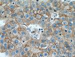 ALCAM Antibody in Immunohistochemistry (Paraffin) (IHC (P))