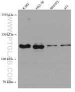 USP25 Antibody in Western Blot (WB)