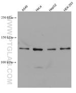 USP25 Antibody in Western Blot (WB)