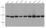 PSMD2 Antibody in Western Blot (WB)