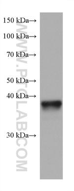 ANKRD1 Antibody in Western Blot (WB)