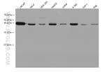 ABHD5 Antibody in Western Blot (WB)