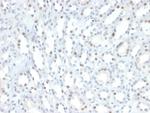 STAT6 (Solitary Fibrous Tumor Marker) Monoclonal Antibody (STAT6/2410)
