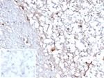STAT6 (Solitary Fibrous Tumor Marker) Recombinant Rabbit Monoclonal Antibody (STAT6/7163R)