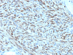STAT6 (Solitary Fibrous Tumor Marker) Antibody in Immunohistochemistry (Paraffin) (IHC (P))