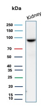 STAT6 (Solitary Fibrous Tumor Marker) Antibody in Western Blot (WB)