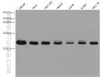 RAB11B Antibody in Western Blot (WB)