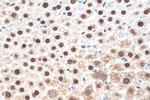 APEX1 Antibody in Immunohistochemistry (Paraffin) (IHC (P))
