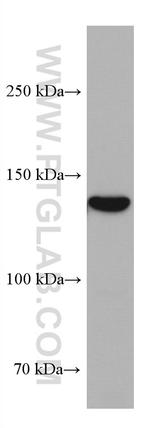 GUCY2C Antibody in Western Blot (WB)
