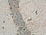 PPP2R2B Antibody in Immunohistochemistry (Paraffin) (IHC (P))