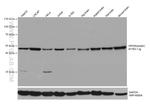 PPP2R2B Antibody in Western Blot (WB)