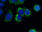 citrate synthase Antibody in Immunocytochemistry (ICC/IF)