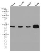 TK1 Antibody in Western Blot (WB)