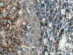 NT5E/CD73 Antibody in Immunohistochemistry (Paraffin) (IHC (P))