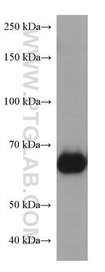 NT5E/CD73 Antibody in Western Blot (WB)
