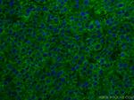 SERBP1 Antibody in Immunohistochemistry (Paraffin) (IHC (P))