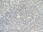 SERBP1 Antibody in Immunohistochemistry (Paraffin) (IHC (P))