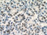 SERBP1 Antibody in Immunohistochemistry (Paraffin) (IHC (P))