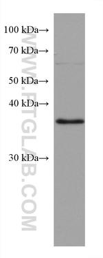 RP2 Antibody in Western Blot (WB)