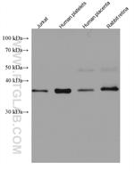 RP2 Antibody in Western Blot (WB)