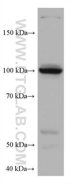 HK3 Antibody in Western Blot (WB)
