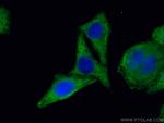LARP1 Antibody in Immunocytochemistry (ICC/IF)