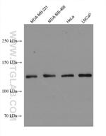 USP28 Antibody in Western Blot (WB)