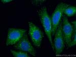 HGS Antibody in Immunocytochemistry (ICC/IF)