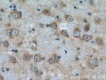 HGS Antibody in Immunohistochemistry (Paraffin) (IHC (P))