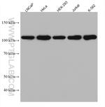 HGS Antibody in Western Blot (WB)