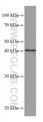 MVK Antibody in Western Blot (WB)
