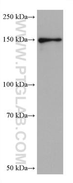 PPARGC1B Antibody in Western Blot (WB)