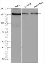 PPARGC1B Antibody in Western Blot (WB)