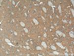 VAMP2 Antibody in Immunohistochemistry (Paraffin) (IHC (P))