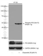Phospho-P53 (Ser15) Antibody in Western Blot (WB)