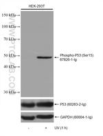 Phospho-P53 (Ser15) Antibody in Western Blot (WB)