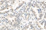 ID1 Antibody in Immunohistochemistry (Paraffin) (IHC (P))