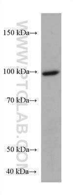 PDE6A Antibody in Western Blot (WB)