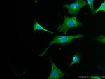 RAB1B Antibody in Immunocytochemistry (ICC/IF)