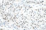 MED4 Antibody in Immunohistochemistry (Paraffin) (IHC (P))