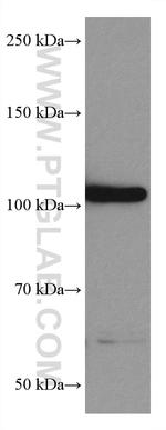 CIP2A Antibody in Western Blot (WB)
