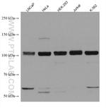CIP2A Antibody in Western Blot (WB)