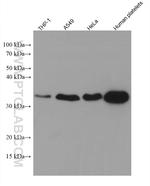 MGLL Antibody in Western Blot (WB)